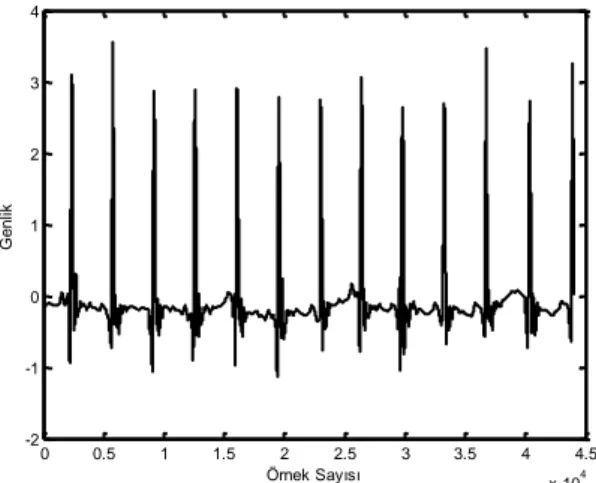 Şekil  3’de  gürültü  oranı  SGO=17.19  dB  için  gürültülü  ECG  sinyalinin gürültüden giderilmiş grafiği verilmiştir 