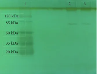Figure 1. SDS-PAGE photograph: Lines 2 and 3; purified the enzyme from 2’,5’-ADP Sepharose 4B matrix: Line 1;