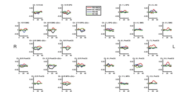 FIGURE A3. Block-averaged time-series results of right-hand TENS stimulation. R: right; L: left; Gr: channels that show group difference in 2 £ 2 (Group £ Hand) repeated measures ANOVA results; AG: angular gyrus; SPG: superior parietal gyrus; SMG: