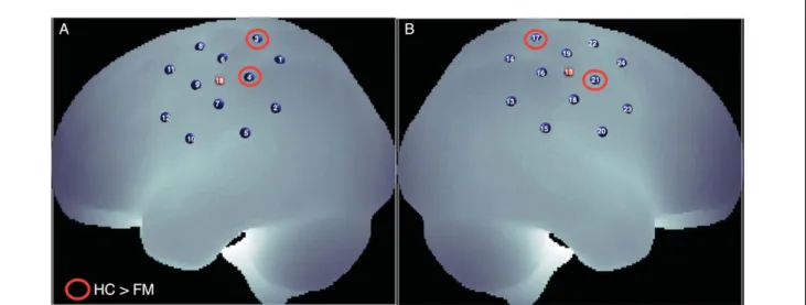 FIGURE 4. Channels that show Hand main effect in finger tapping task marked on MNI space: (a) left hemisphere; (b) right hemi- hemi-sphere (L: left; R: right)