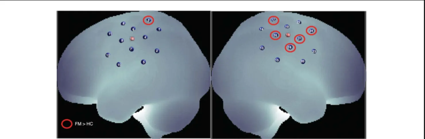 FIGURE 6. Correlation plots of (a) left-hand pain threshold and block-averaged mean DHbO 2 of left-hand MNS data for channel 3 (left superior parietal gyrus) and (b) left-hand pain threshold and block-averaged mean DHbO 2 of left-hand MNS data for channel 