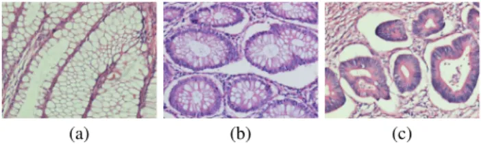 Fig. 1. Examples of histopathological images of colon glands. For gland instance segmentation, it is more difficult to correctly classify boundary pixels when two glands are very close to each other