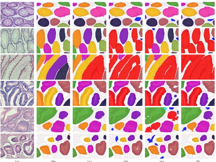 Fig. 4. (a) Example test set images containing normal (first three rows) and cancerous (last three rows) glands