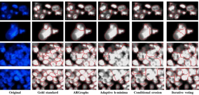 Fig. 13. Top two rows: results for subimages containing inner intensity variation and texture