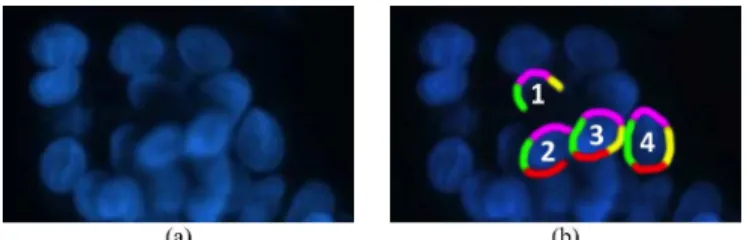 Fig. 1. (a) An image of HepG2 hepatocellular carcinoma cell nuclei. (b) For four individual nuclei, the left, right, top, and bottom boundaries are shown as green, yellow, pink, and red, respectively.