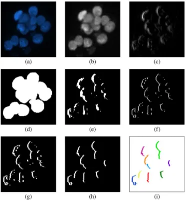 Fig. 2. Defining left boundary primitives: (a) original subimage, (b) blue band of the image, (c) response map obtained by applying the Sobel operator , (d) mask used to determine local Sobel threshold levels, (e) binary image after thresholding, (f) bound