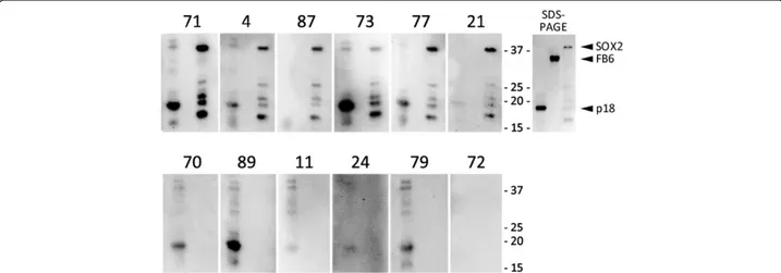 Table 2 SOX2 antibody and protein staining characteristics of SCLC patients (Continued)