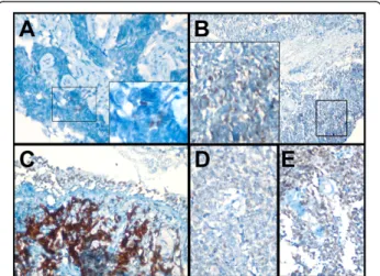 Table 4 SOX2 antibody correlates with intensity of SOX2 protein expression