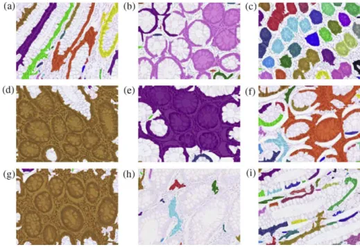 Fig. 9. The visual results obtained by the nuclei-identiﬁcation based approach for the tissue images given in Fig