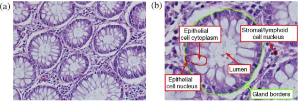 Fig. 2. Histopathological images of colon tissues, which are stained with the routinely used hematoxylin-and-eosin technique