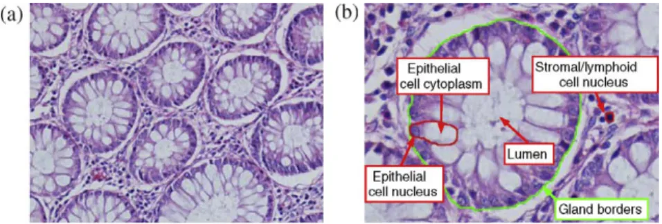 Fig. 2. Histopathological images of colon tissues, which are stained with the routinely used hematoxylin-and-eosin technique
