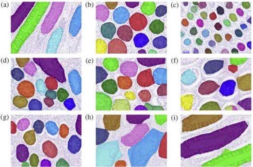 Fig. 7. The visual results obtained by the object-graph approach for the tissue images given in Fig