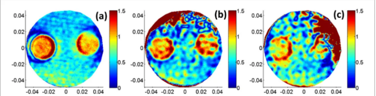 Figure 6.  Experimental conductivity reconstructions: standard MR-EPT reconstructions of the quadrature drive, top shadowed  and right shadowed excitation configurations in (a),(b), and (c), respectively