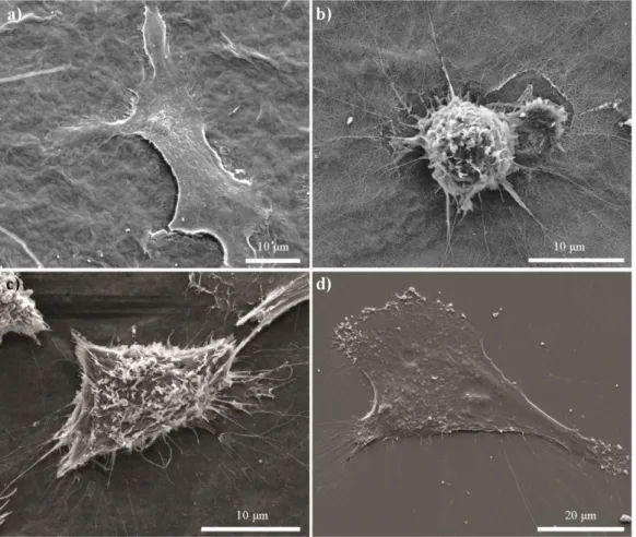 Figure  2.12  SEM  images  of  corneal  fibroblasts  cultured  on  (A)  YIGSR-PA  coated surface, (B) KKRGD-PA coated surface, (C) K-PA coated surface and,  (D) collagen coated surface show the adhesion profiles of cells