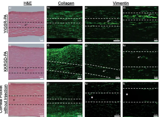 Fig. 9. IHC analyses of rabbit corneas at week 7. Sections from (a–d) YIGSR-PA injected, (b–h) KKRGD-PA injected and (i–l) corneal pocket without injection samples