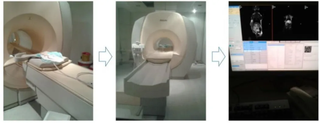 Figure 2. 17 MRI procedure.  