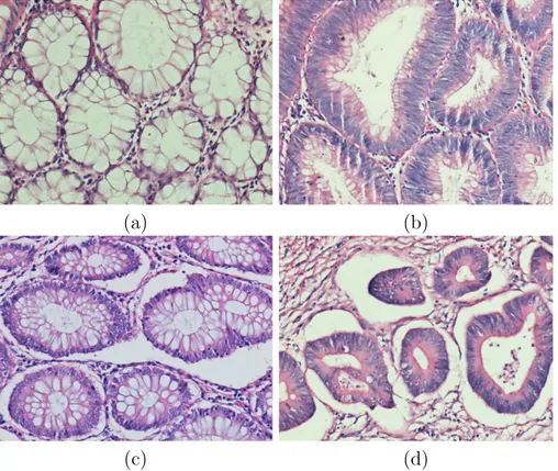 Figure 1.1: Examples of histopathological images of colon glands. The images shown in (a) and (b) illustrate the cases in which the glands are very close to each other