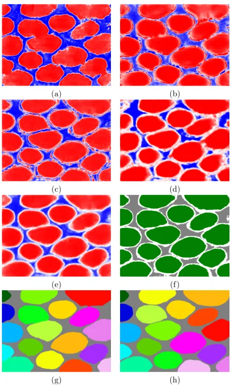 Figure 3.3: Gland segmentation for a test set image I. (a)-(d) Posterior maps Y b i (I) for first, second, third, and fourth stage respectively