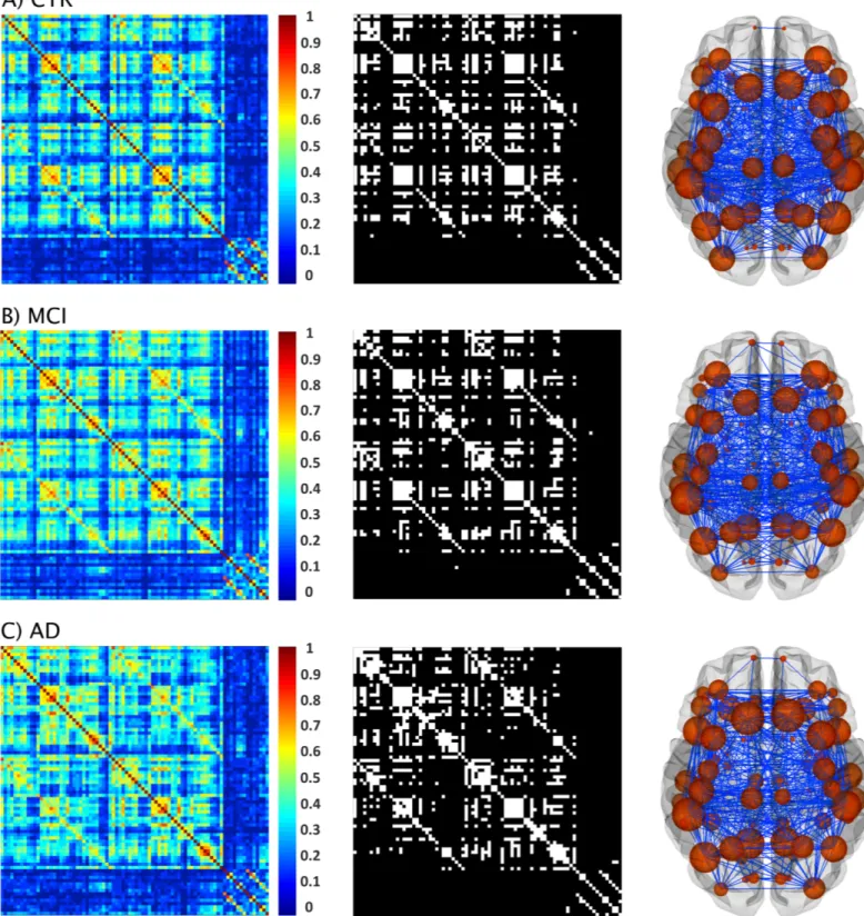Fig 4. Structural brain networks in controls, MCI patients, and AD patients. From left to right: weighted correlation matrices of 82 regions, binary correlation matrices after fixing density at 15%, and corresponding brain graphs from A) controls (CTR), B)