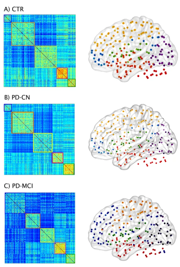 Fig 7. Functional brain networks and modules in controls and PD-MCI patients. Weighted connectivity matrices and modules in A) controls (CTR) and Parkinson’s disease patients B) with normal cognition (PD-CN) and C) with mild cognitive impairment (PD-MCI)