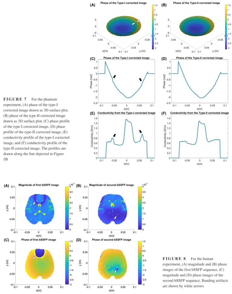 FIGURE 8  For the human  experiment, (A) magnitude and (B) phase  images of the first bSSFP sequence, (C)  magnitude and (D) phase images of the  second bSSFP sequence