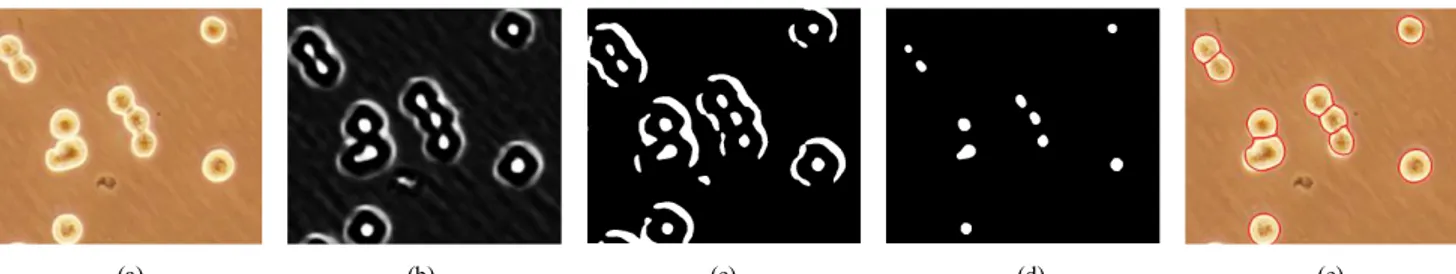 Şekil 3. Örnek hücre görüntüsünde, işaretçi tespiti ve hücre bölütlenmesi aşamaları: (a) Orijinal görüntü, (b) DVM sonucu olasılık haritası, (c) eşikleme  sonucu işaretçi pikselleri, (d) maske kullanılarak elde edilen işaretçiler ve (e) işaretçilerin su-se