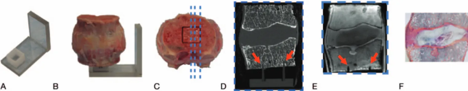 Figure 1. Method for coaligning histology and MR images. (A, B) Motion segment is placed on rigid alignment guide with 13  13 mm mounting square; (C) histology, HR-pQCT, and MR images are taken parallel to alignment channels of mounting square to ensure i
