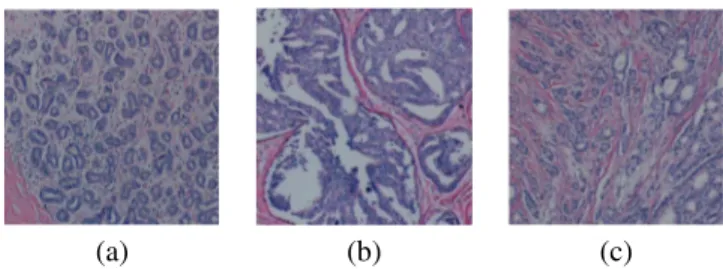 Fig. 1. Microscopic images of tissue samples surgically removed from human breast tissues: (a) a benign tissue example, (b) an in-situ tissue example, (c) an invasive tissue example.