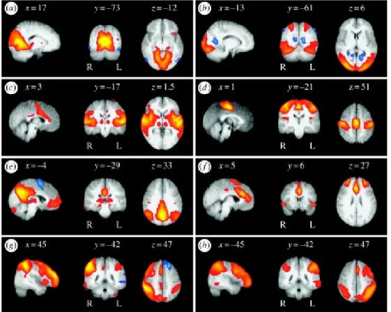 Figure 3.3: PICA-estimated resting state patterns from [6]. (a) Medial visual cortical areas, (b) lateral visual cortical areas, (c) auditory system, (d)  sensory-motor system, (e) visuo-spatial system, (f) executive control, (g,h) dorsal visual system.