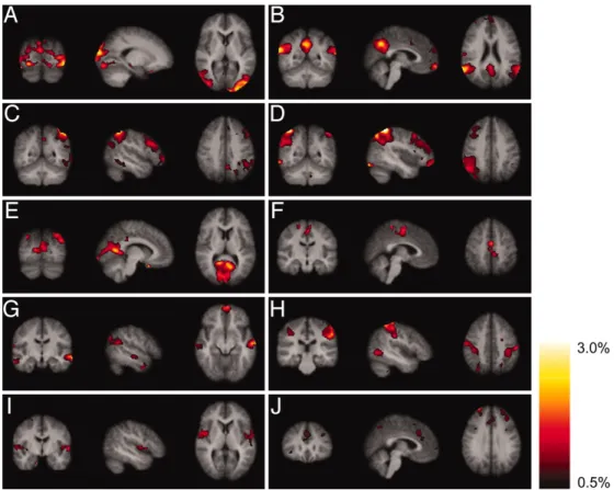Figure 3.4: Mean tensor-PICA estimated resting state patterns from [7]. Com- Com-bined results of two different analyses revealed 10 coherent resting fluctuations.