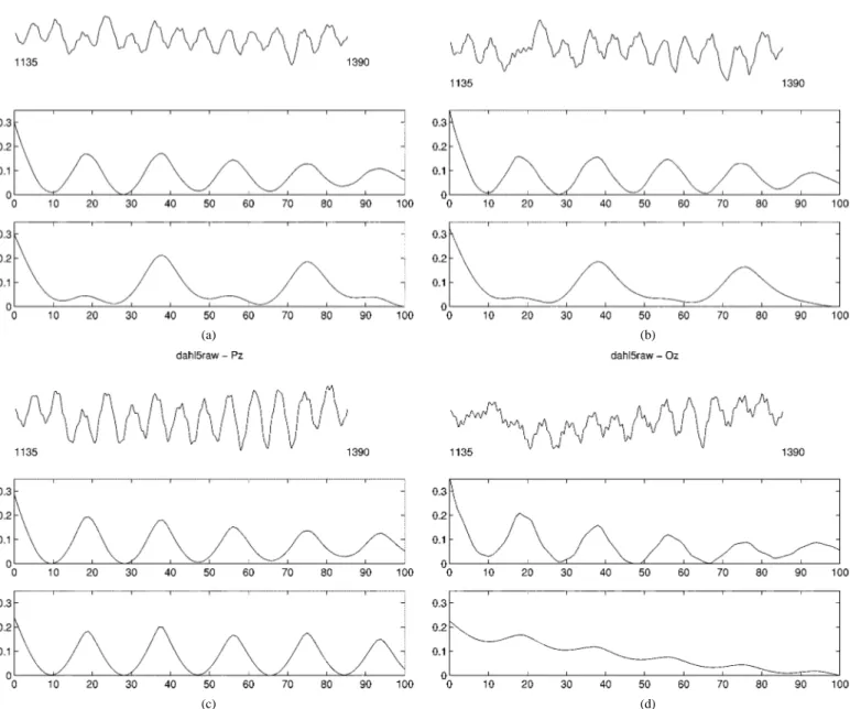 Fig. 3. EEG segments of Cz, Fz, Pz and Oz from samples 1135–1390 (top plots), mAMDF measurements (middle plots), mAMDFSoA of data with lag 100 (bottom plots) in (a), (b), (c), and (d); respectively.