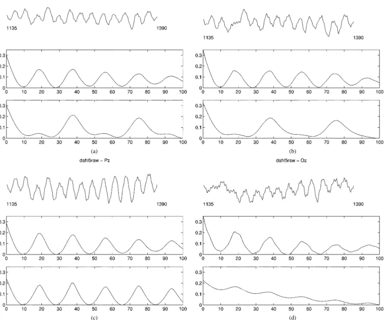Fig. 3. EEG segments of Cz, Fz, Pz and Oz from samples 1135–1390 (top plots), mAMDF measurements (middle plots), mAMDFSoA of data with lag 100 (bottom plots) in (a), (b), (c), and (d); respectively.