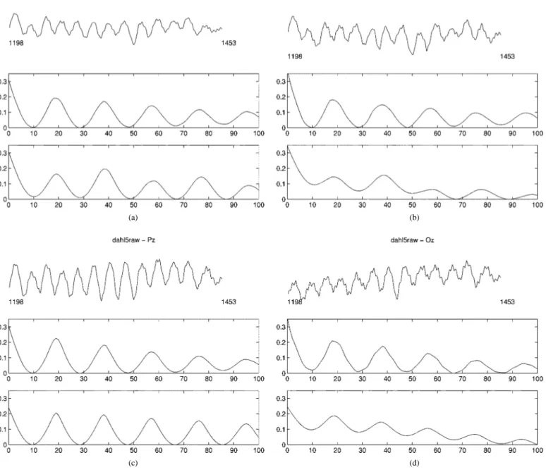 Fig. 4. EEG segments of Cz, Fz, Pz and Oz from samples 1198–1453 (top plots), mAMDF measurements (middle plots), mAMDFSoA of data with lag 100 (bottom plots) in (a), (b), (c), and (d); respectively.