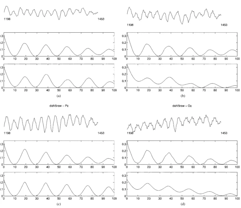 Fig. 4. EEG segments of Cz, Fz, Pz and Oz from samples 1198–1453 (top plots), mAMDF measurements (middle plots), mAMDFSoA of data with lag 100 (bottom plots) in (a), (b), (c), and (d); respectively.