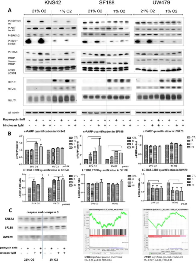 Figure 5: Cell effects of rapamycin, irinotecan and the combination and impact on the mTOR-HIF-1/2α pathway in  KNS42, SF188 and UW479 in both normoxic and hypoxic conditions