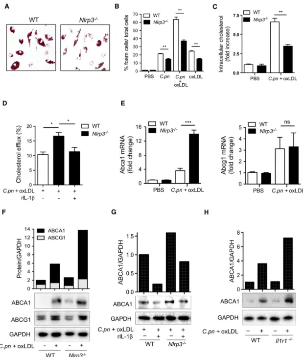 Figure 3. IL-1 Signaling Suppresses ABCA1-Cholesterol Efflux in C.pn-Infected Macrophages and Promotes Foam Cell Formation (A) Representative pictures of foam cells stained with oil red O are shown.
