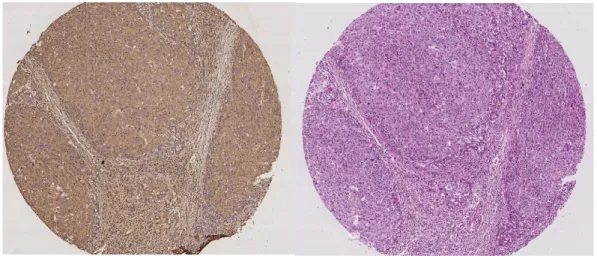 Figure 2.1: CD13 (left) and H&amp;E (right) stained successive tissue layer images of the same patient.