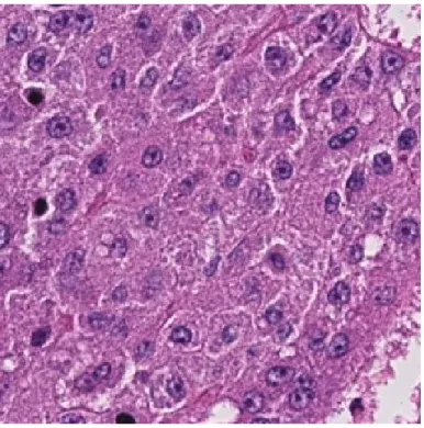 Figure 2.4: Microscopic Image of an H&amp;E Stained Grade I (CSC density&lt; 5%) Liver Tissue Image