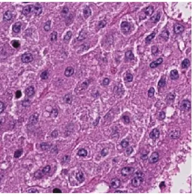 Figure 2.4: Microscopic Image of an H&amp;E Stained Grade I (CSC density< 5%) Liver Tissue Image