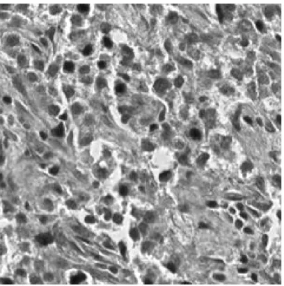 Figure 2.8: R Channel of an H&amp;E Stained RGB Liver Tissue Image