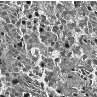 Figure 2.10: B Channel of an H&amp;E Stained RGB Liver Tissue Image achieved in three-class image and patient classification respectively
