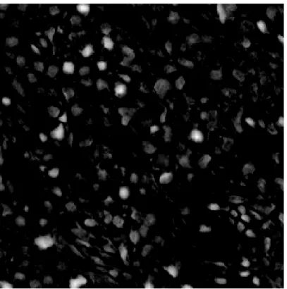 Figure 2.14: H Channel of an H&amp;E Stained HE Liver Tissue Image