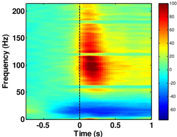 Fig.  2.  The  average  time  frequency  map  computed  from  all subjects using the most reactive channel set selected for each