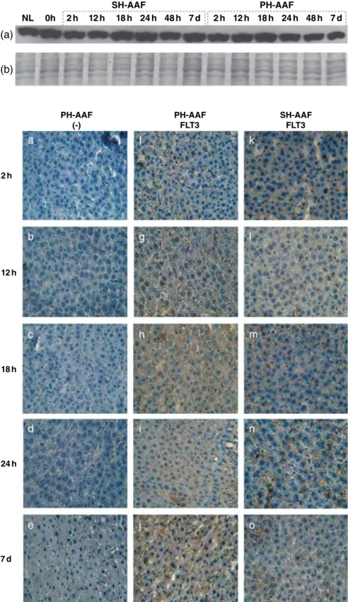 Figure 6 Expression of proteins extracted from 2-AAF-treated sham hepatectomy (SH) and partial hepatectomy (PH) groups by (a) Western blotting with anti-FLT3 antibody and (b) SDS-PAGE with Coomassie staining.