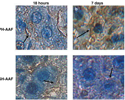 Figure 8 Cellular localization of FLT3 protein in (a,b) partial hepatectomy (PH) and (c,d) sham hepatectomy (SH) groups at 18 h and 7 days