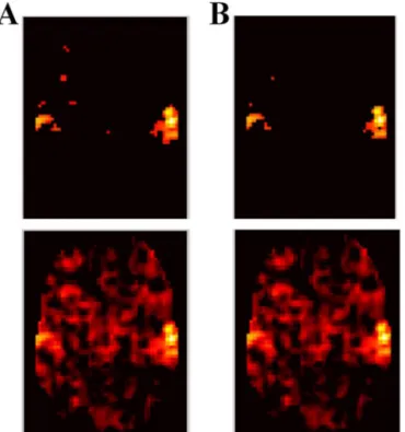 Fig. 7. Clusters in a transparent brain image when running the (a) GNG and (b) RGNG clustering techniques.