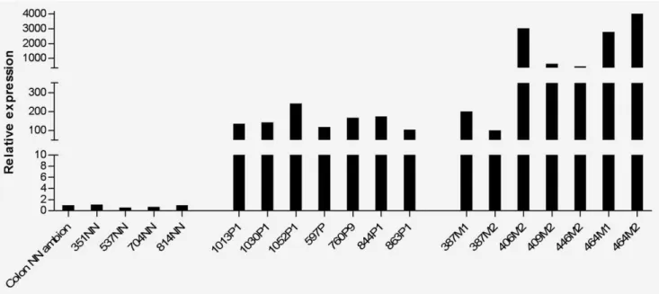 Figure 6. CCAT1 expression in adenomatous polyps and CRC metastases. CCAT1 expression in healthy control RNA (Colon NN Ambion, 351NN, 537NN, 704NN, 814NN) and in RNA from adenomatous polyps from 7 patients (1013P1, 1030P1, 1052P1, 597P, 760P9, 844P1, 863P1