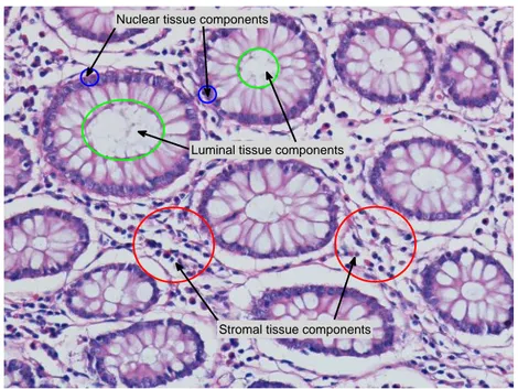 Figure 1.1: Histological image of a typical colon tissue and the corresponding color graph representation.