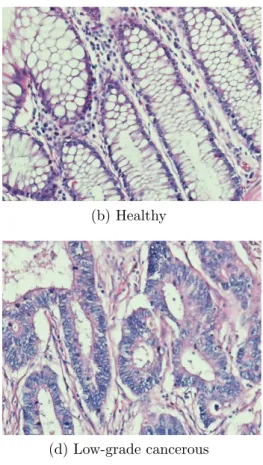 Figure 2.2: Histopathological images of colon tissues. These tissues are stained with the hematoxylin-and-eosin technique, which is a routinely used staining procedure in histopathology.