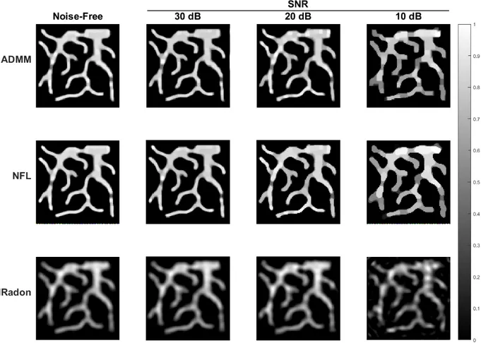 Figure 7: Final images of ADMM, NFL, and IRadon solutions for noise-free, 30 dB SNR, 20 dB SNR, and 10 dB SNR cases.